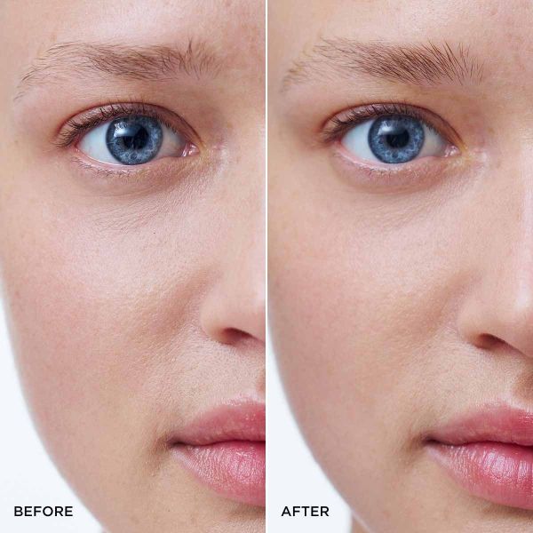 The product itself is not visible in this image, which shows a before-and-after comparison of skin.